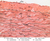 a27 elastic artery aorta verhoeff 40x labeled.jpg