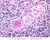 a45 medulla infant thymus 40x labeled.jpg