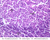b20 lymphoid nodule appendix 40x labeled.jpg