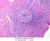 b20 lymphoid nodule appendix 10x labeled.jpg