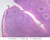 a41b lymphoid nodules tonsils 2x labeled.jpg