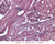 a34 trabeculae lymph node 40x labeled.jpg