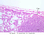 a32c lymph node 20x labeled.jpg
