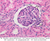 b67 macula densa renal corpuscle 40x he labeled.jpg