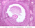 b94 secondary antral follicle 10x labeled.jpg