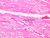 a25b cardiac muscle left ventricle 40x labeled.jpg