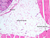 a73b adipose tissue neck 10x labeled.jpg