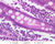 b12b plasma cell jejunum 40x labeled.jpg