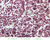 a34b reticular tissuee lymph node 40x labeled.jpg