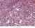 a37b reticular tissue spleen 40x retic labeled.jpg