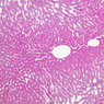 B35, Liver (Sinusoids), 10x (PAS)