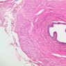 B83, Spermatic Cord, 10x (H&E)