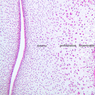 A11, Foot (Fetal), 10x Labeled (H&E)