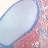 A6, Costal Cartilage, 2.5x (Aniline Blue)