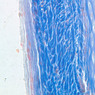 A6, Costal Cartilage, 40x (Aniline Blue)