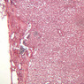 A34, Lymph Node, 10x (Reticulin)