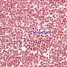 A34, Lymph Node, 40x Labeled (Reticulin)