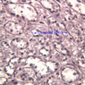 A37, Spleen, 40x Labeled (Reticulin)