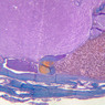 B54, Pituitary, 2.5x (AF)