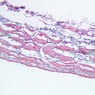 A28, Renal Artery and Vein, 10X (AF)