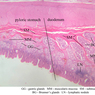 B10, Pyloroduodenal Junction, 2.5x Labeled (H&E)