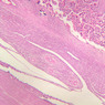 A97, Placenta (3rd Trimester), 2.5x (H&E)