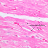 A25, Left Ventricle (Cardiac Muscle), 40x Labeled (H&E)