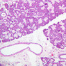 B44, Submandibular Gland, 10x (H&E)