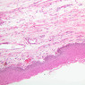 A67, Epiglottis (Lingual Surface), 10x (H&E)