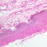 A67, Epiglottis (Lingual Surface), 20x (H&E)