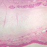 A67, Epiglottis (Lingual Surface), 2.5x (H&E)