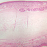 A67, Epiglottis (Pharyngeal Surface), 2.5x (H&E)