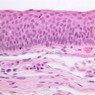 A67, Epiglottis (Pharyngeal Surface), 40x (H&E)